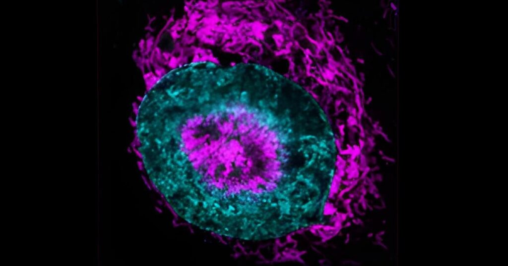 Physically squeezing cancer cells boosts their survival