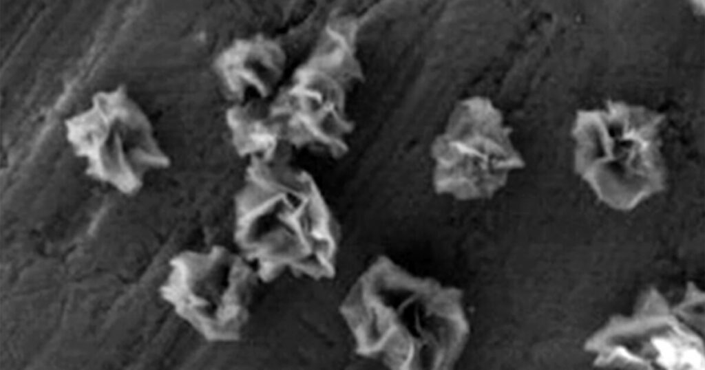 Metallic nanoflowers show promise for brain health