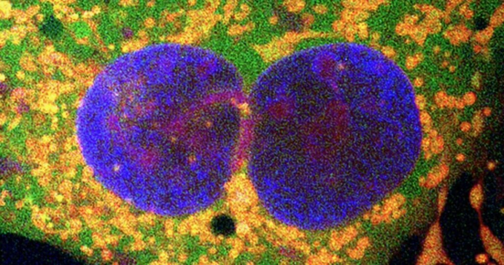 Bacterial Retrons Revolutionize Gene Editing for Multiple Diseases