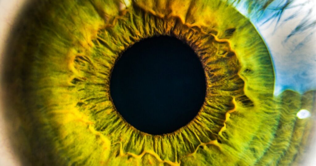 Predict osteoporosis early using eye scan signs